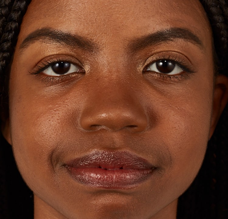 complexion after
